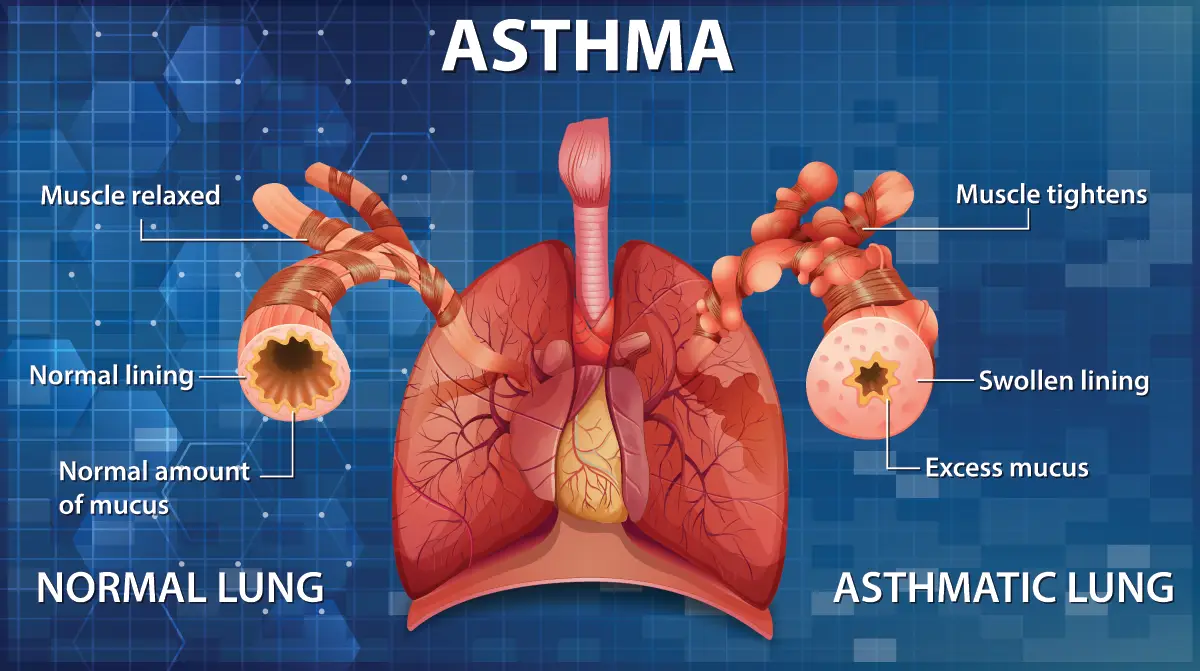 Lung showing normal and asthmatic lung